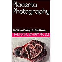 Placenta Photography: The Wild and Fleeting Life of the Placenta Placenta Photography: The Wild and Fleeting Life of the Placenta Kindle Paperback