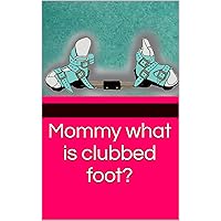 Mommy what is clubbed foot? Mommy what is clubbed foot? Kindle Paperback
