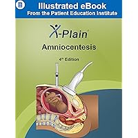 X-Plain ® Amniocentesis X-Plain ® Amniocentesis Kindle