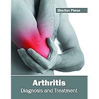 Arthritis: Diagnosis and Treatment