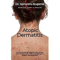 Comprehensive Insights into Atopic Dermatitis: From Pathophysiology to Holistic Management (Medical care and health)