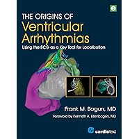 The Origins of Ventricular Arrhythmias: Using the ECG as a Key Tool for Localization The Origins of Ventricular Arrhythmias: Using the ECG as a Key Tool for Localization Kindle Paperback