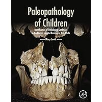 Paleopathology of Children: Identification of Pathological Conditions in the Human Skeletal Remains of Non-Adults Paleopathology of Children: Identification of Pathological Conditions in the Human Skeletal Remains of Non-Adults Hardcover Kindle