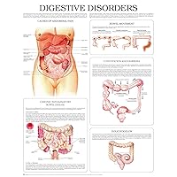 Digestive disorders e chart: Full illustrated
