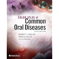 Color Atlas of Common Oral Diseases Color Atlas of Common Oral Diseases Paperback Kindle