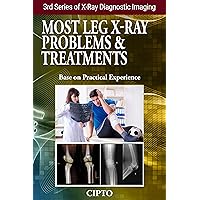 Most Leg X-Ray Problems and Treatments: Important information of leg pain problems and further therapy (X-Ray Diagnostic Imaging Book 3) Most Leg X-Ray Problems and Treatments: Important information of leg pain problems and further therapy (X-Ray Diagnostic Imaging Book 3) Kindle Paperback