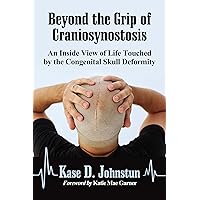 Beyond the Grip of Craniosynostosis: An Inside View of Life Touched by the Congenital Skull Deformity Beyond the Grip of Craniosynostosis: An Inside View of Life Touched by the Congenital Skull Deformity Kindle Paperback