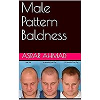 Male Pattern Baldness (Health Care Book 1)