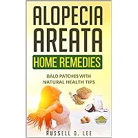 Alopecia: Alopecia Areata Home Remedies…Bald Patches With Natural Health Tips (Alopecia, Hair Loss, Hair Loss Cures, Hair Loss Protocol, Hair Loss Solutions)