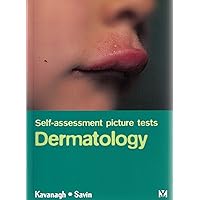 Self Assessment Picture Tests in Dermatology Self Assessment Picture Tests in Dermatology Hardcover