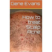 How to treat Scalp Acne