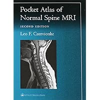 Pocket Atlas of Spinal MRI (Radiology Pocket Atlas Series) Pocket Atlas of Spinal MRI (Radiology Pocket Atlas Series) Paperback