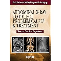 ABDOMINAL X-RAY TO DETECT PROBLEM CAUSES & TREATMENT: Base on Practical Experience (X-Ray Diagnostic Imaging Book 2) ABDOMINAL X-RAY TO DETECT PROBLEM CAUSES & TREATMENT: Base on Practical Experience (X-Ray Diagnostic Imaging Book 2) Kindle Paperback