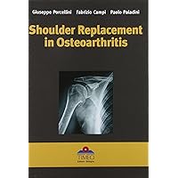 Shoulder Replacement in Osteoarthritis Shoulder Replacement in Osteoarthritis Hardcover