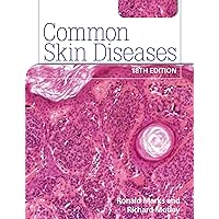 Common Skin Diseases 18th edition: ISE Common Skin Diseases 18th edition: ISE Hardcover Paperback