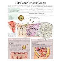 HPV and Cervical Cancer e-chart: Full illustrated