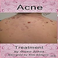 Acne Treatment: How To... Acne Treatment: How To... Audible Audiobook Kindle Paperback