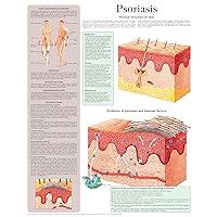 Psoriasis e-chart: Full illustrated