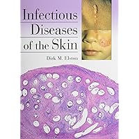 Infectious Diseases of the Skin Infectious Diseases of the Skin Hardcover Paperback
