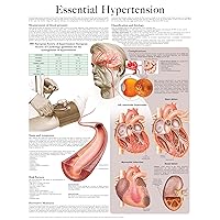 Essential Hypertension e-chart: Full illustrated