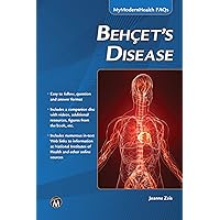 Behcet’s Disease (MyModernHealth FAQs) Behcet’s Disease (MyModernHealth FAQs) Paperback Kindle