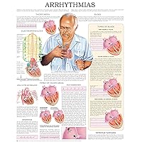 Arrhythmias, e-chart: Quick reference guide