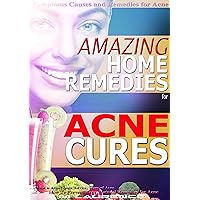 ACNE CURE: Amazing Home Remedies for Acne, Symptoms Causes and Remedies For Acne, Natural Remedies for Acne, How To Prevent Acne, What is Acne? Acne Advice, Types of Acne