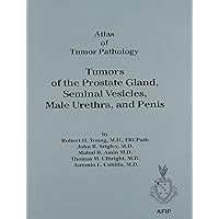 Tumors of the Prostate, Seminal Vesicles, Male Urethra and Penis: 28 (Atlas of Tumor Pathology (AFIP) 3rd Series) Tumors of the Prostate, Seminal Vesicles, Male Urethra and Penis: 28 (Atlas of Tumor Pathology (AFIP) 3rd Series) Paperback