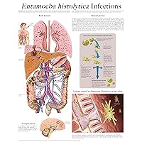 Entamoeba histolytica Infections e-chart: Full illustrated