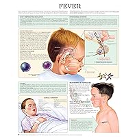 Fever e chart: Full illustrated