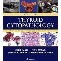 Atlas of Thyroid Cytopathology: With Histopathologic Correlations Atlas of Thyroid Cytopathology: With Histopathologic Correlations Hardcover Kindle