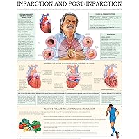 Infarction and Post Infarction e-chart: Quick reference guide