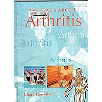 The Facts About Arthritis The Facts About Arthritis Library Binding Paperback