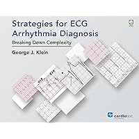 Strategies for ECG Arrhythmia Diagnosis: Breaking Down Complexity Strategies for ECG Arrhythmia Diagnosis: Breaking Down Complexity Hardcover Paperback