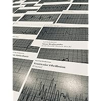EKG ECG Cardiac Acls Rhythm Strip Flashcards