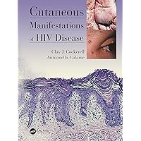 Cutaneous Manifestations of HIV Disease Cutaneous Manifestations of HIV Disease Kindle Hardcover Paperback