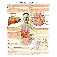 Hepatitis C e chart: Full illustrated