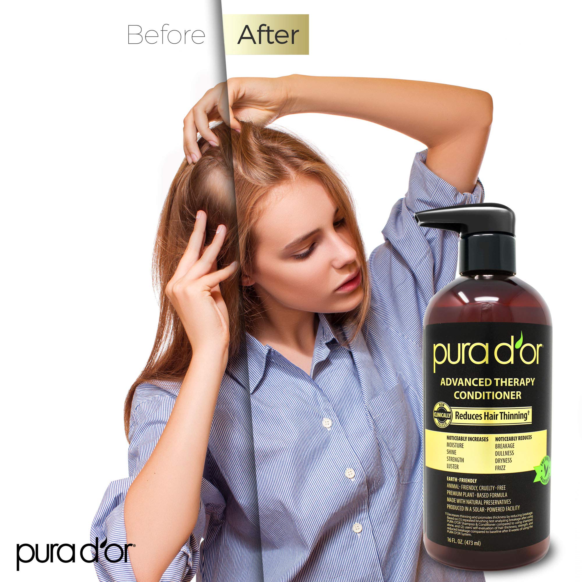 PURA D'OR Advanced Therapy Conditioner (16oz) For Increased Moisture, Strength, Volume & Texture, No Sulfates, Made with Argan Oil & Biotin, All Hair Types, Men & Women (Packaging May Vary)