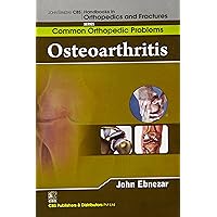 Osteoarthritis (Handbooks In Orthopedics And Fractures Series, Vol. 87 -Common Orthopedic Problems) Osteoarthritis (Handbooks In Orthopedics And Fractures Series, Vol. 87 -Common Orthopedic Problems) Hardcover Paperback