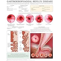 Gastroesophageal reflux disease e-chart: Quick reference guide