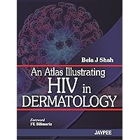 An Atlas Illustrating HIV in Dermatology An Atlas Illustrating HIV in Dermatology Paperback
