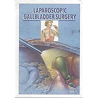 Laparoscopic Gallbladder Surgery