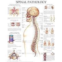 Spinal Pathology - Quick Reference Chart: Full illustrated