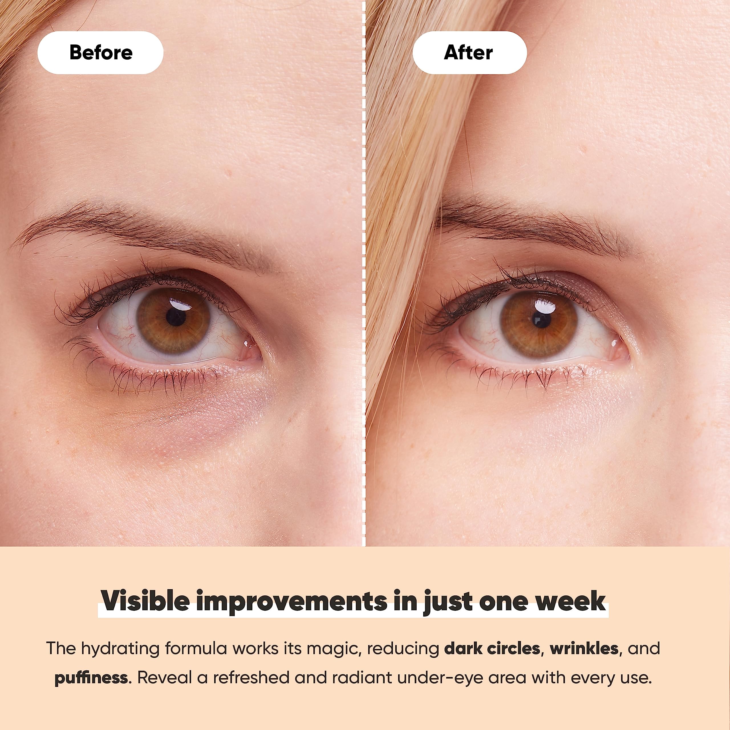 LE GUSHE Under Eye Patches (20 Pairs) 24K Gold Eye Mask - Anti-Aging, Hyaluronic Acid & Collagen Eye Treatment To Reduce Dark Circles, Puffy Eyes & Wrinkles - Transforms Tired Eyes