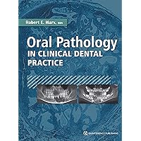 Oral Pathology in Clinical Dental Practice Oral Pathology in Clinical Dental Practice Kindle Hardcover