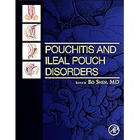 Pouchitis and Ileal Pouch Disorders: A Multidisciplinary Approach for Diagnosis and Management Pouchitis and Ileal Pouch Disorders: A Multidisciplinary Approach for Diagnosis and Management Hardcover Kindle