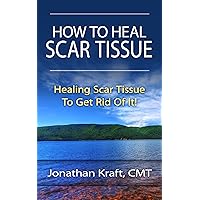 How to Heal Scar Tissue: How To Heal Your Own Scar Tissue And Get Rid Of It How to Heal Scar Tissue: How To Heal Your Own Scar Tissue And Get Rid Of It Kindle Paperback