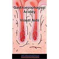 Gastroesophageal Acidity Visual Aids: Full Illustrated 2016