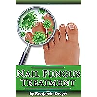 Nail Fungus Treatment Nail Fungus Treatment Kindle