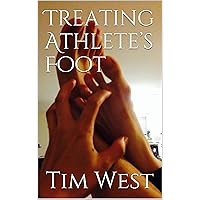 Treating Athlete’s Foot: A Self Treatment and Care Guide For Those With Itchy Feet